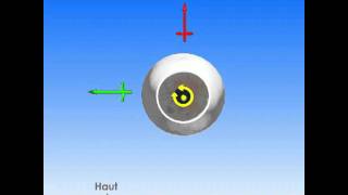 Glaucome  causes symptômes et traitements Dr Roemer Swiss Visio Network [upl. by Henderson49]