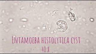 Entamoeba Histolytica cyst under microscope at 40X [upl. by Comstock616]