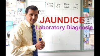 Jaundice  Laboratory Diagnosis [upl. by Hgielhsa]