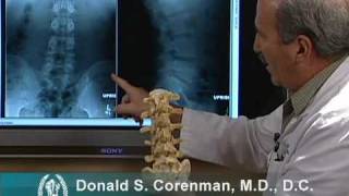 Diagnostic Imaging Explained XRay  CT Scan  Ultrasound  MRI [upl. by Samuelson]