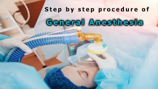 What is Pre Anaesthesia checkup clinic  Dr Anupama T Srikanth [upl. by Ahseele198]