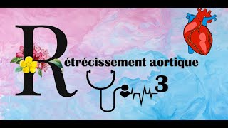 Rétrécissement aortique [upl. by Marcos]