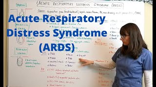 Acute Respiratory Distress Syndrome ARDS [upl. by Launamme]