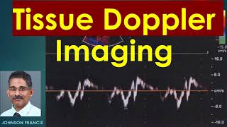 Tissue Doppler Imaging [upl. by Gough]