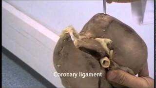 Gross anatomy of the liver [upl. by Grani655]