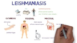 What is Leishmaniasis An introduction and overview [upl. by Britni484]