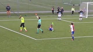 GRAPHIC Soccer Goalie BREAKS Opponents Leg in Tackle [upl. by Sinnylg]