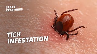 WARNING The Most Horrific Tick Infestations [upl. by Alyson596]