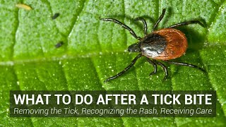 What to Do After a Tick Bite  Johns Hopkins Lyme Disease Research Center [upl. by Sukramaj]