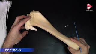 Lateral Knee Finding the Lateral Notch [upl. by Abate932]