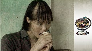 The Horrific Impact Of Agent Orange In Vietnam 2003 [upl. by Airdni962]