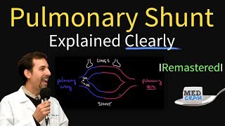 Understanding Shunt Fraction QpQs [upl. by Alyag]