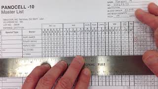 Blood Bank  Antibody Identification I [upl. by Zoara]