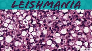 Leishmaniasis 5Minute Pathology Pearls [upl. by Reinald342]