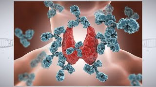 Understanding Autoimmune Thyroid Disease [upl. by Denver795]