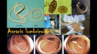 Ascaris lumbricoides [upl. by Onid]