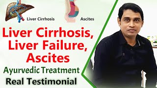 Liver Cirrhosis Liver Failure Ascites  Ayurvedic Treatment  True Testimonial [upl. by Yssirk]