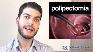 Como é a retirada de pólipos intestinais [upl. by Aissat]