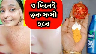 ফর্সা হবার সহজ উপায়েforsa howar sohoj upaytomato facialGlow Facial [upl. by Sayer]