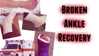 Broken Ankle Recovery From Surgery to Today w Pictures [upl. by Anaiek]