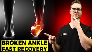 BEST Ankle Fracture amp Broken Ankle Recovery Time 2024 25 BEST TIPS [upl. by Jordanson]