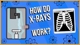 How do XRays Work [upl. by Struve]