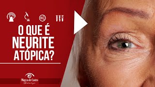 O que é a Neurite Óptica  Dr Marcos de Castro Oftalmologia [upl. by Lalaj]