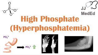 High Phosphate Hyperphosphatemia Dietary Sources Causes Symptoms Treatment [upl. by Beach]