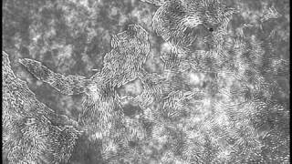 Pseudomonas aeruginosa PAO1 twitching motility [upl. by Reece756]