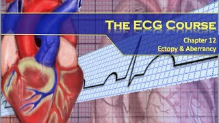 The ECG Course  Ectopy amp Aberrancy [upl. by Yecad835]