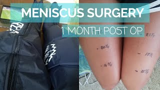 Do I Have A Meniscus Tear  Knee Tests You Can Do At Home [upl. by Petronella]