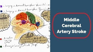 ct angio cerebral artery [upl. by Sally789]