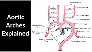 ATHEROSCLEROSIS and CARDIOVASCULAR DISEASE [upl. by Karlise]