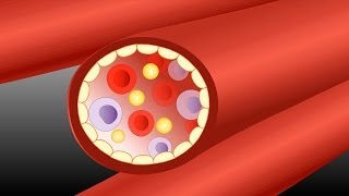 Supraventricular Arrhythmias by C LaGrasta  OPENPediatrics [upl. by Itch403]