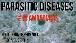 Parasitic Diseases Lectures 16 Amoebiasis [upl. by Nymzaj]