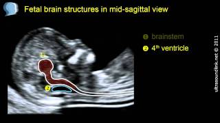 Ultrasound Imaging of the placenta Part 1 Anatomy and Variants [upl. by Zaragoza862]