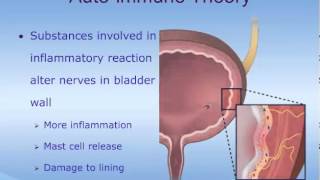 Understanding Interstitial Cystitis IC [upl. by Fancie]