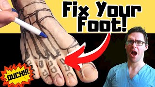 Broken Foot Recovery amp Foot Fracture Home Treatments Top 25 Hacks [upl. by Aiseneg]