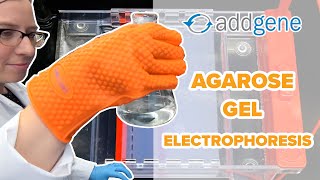 Agarose Gel Electrophoresis [upl. by Lirba]