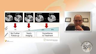 Small Renal Masses An Overview [upl. by Oramug]