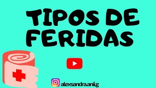 Tipos de Ferida  Vídeo Aula 2021 [upl. by Sadnac]