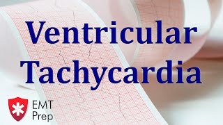 Ventricular Tachycardia ECG  EMTprepcom [upl. by Yddur]