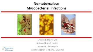 Nontuberculous Mycobacterial Infections 2019 [upl. by Merth597]