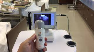 Caresono Bladder Scanner HowTo [upl. by Roban707]