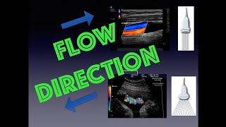 How to Determine Blood Flow Direction with Ultrasound and Doppler [upl. by Jariv]