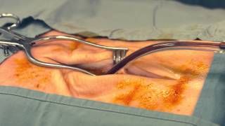 Dr Scalpels Guide to Surgery Dealing with Bleeding Episode 7 [upl. by Aitam522]