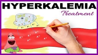 Hyperkalemia with ECG changes Treatment  Mnemonic Series 15 [upl. by Hendry]