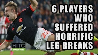 6 Players Who Suffered Horrific Leg Breaks [upl. by Cerellia]