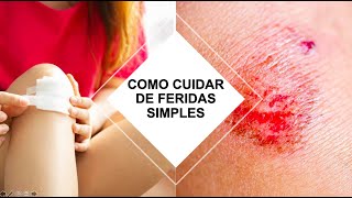 COMO CUIDAR DE FERIDAS SIMPLES Por Luiz Gameiro dermatologista [upl. by Bond748]