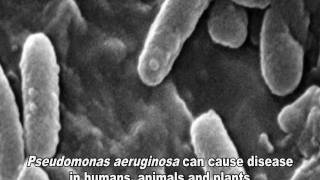 Pseudomonas aeruginosa Infections [upl. by Sylera]